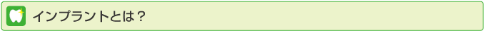 インプラントとは?